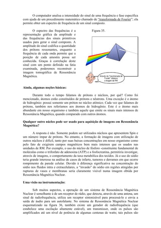 O computador analisa a intensidade do sinal de uma frequência e fase específica
com ajuda de um procedimento matemático chamado de “transformada de Fourier”; ela
permite obter um espectro de frequência de um sinal composto.
O espectro das frequências é a
representação gráfica da amplitude e
das frequências dos sinais primitivos
usados para gerar o sinal composto. A
amplitude do sinal codifica a quantidade
dos prótons ressonantes, enquanto a
frequência de cada onda permite que a
posição de cada amostra possa ser
conhecida. Graças à correlação deste
sinal com um ponto definido na fatia
examinada, poderemos reconstruir a
imagem tomográfica de Ressonância
Magnética.
Figura 35.
Ainda, algumas noções básicas:
Durante todo o tempo falamos de prótons e núcleos, por quê? Como foi
mencionado, átomos estão constituídos de prótons e nêutrons. Uma exceção é o átomo
de hidrogênio: possui somente um próton no núcleo atômico. Cada vez que falamos de
prótons, também nos referíamos aos átomos de hidrogênio. Este é o átomo mais
abundante em nosso organismo e também aquele que emite os sinais mais intensos de
Ressonância Magnética, quando comparado com outros átomos.
Qualquer outro núcleo pode ser usado para aquisição de imagens em Ressonância
Magnética?
A resposta é não. Somente podem ser utilizados núcleos que apresentem Spin e
um número ímpar de prótons. No entanto, a formação de imagens com utilização de
outros núcleos é difícil, tanto por suas baixas concentrações em nosso organismo como
pelo fato de exigirem campos magnéticos bem mais intensos que os usados nas
unidades de RM. Por exemplo, o uso do núcleo de fósforo -constituinte fundamental de
moléculas como o trifosfato de adenosina (ATP) e a fosfocreatina, permitiria investigar,
através de imagens, o comportamento da taxa metabólica dos tecidos. Já o uso do sódio
teria grande interesse na análise de casos de infarto, tumores e derrames em que ocorre
rompimento da parede celular. Devido à diferença significativa na concentração do
sódio nos fluidos intra e extracelulares, a “invasão” do sódio em regiões atingidas por
rupturas de vasos e membranas seria claramente visível numa imagem obtida por
Ressonância Magnética Nuclear.
Uma visão na instrumentação:
Sob muitos aspectos, a operação de um sistema de Ressonância Magnética
Nuclear é semelhante à de um receptor de rádio, que detecta, através de uma antena, um
sinal de radiofrequência, utiliza um receptor sintonizável para processá-lo e envia a
saída de áudio para um autofalante. No sistema de Ressonância Magnética Nuclear
esquematizado na figura 36, também existe um gerador de radiofrequência (que
estabelece uma oscilação altamente estável), um transmissor, onde os pulsos são
amplificados até um nível de potência de algumas centenas de watts; tais pulsos são
 