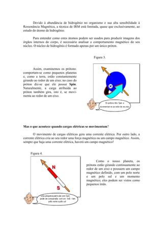 Devido à abundância de hidrogênio no organismo e sua alta sensibilidade à
Ressonância Magnética, a técnica de IRM está limitada, quase que exclusivamente, ao
estudo do átomo de hidrogênio.
Para entender como estes átomos podem ser usados para produzir imagens dos
órgãos internos do corpo, é necessário analisar o comportamento magnético do seu
núcleo. O núcleo de hidrogênio é formado apenas por um único próton.
Assim, examinemos os prótons:
comportam-se como pequenos planetas
e, como a terra, estão constantemente
girando ao redor de um eixo; no caso do
próton diz-se que ele possui Spin.
Naturalmente, a carga atribuída ao
próton também gira, isto é, se movi-
menta ao redor de um eixo.
Figura 3.
Mas o que acontece quando cargas elétricas se movimentam?
O movimento de cargas elétricas gera uma corrente elétrica. Por outro lado, a
corrente elétrica cria ao seu redor uma força magnética ou um campo magnético. Assim,
sempre que haja uma corrente elétrica, haverá um campo magnético!
Figura 4.
Como o nosso planeta, os
prótons estão girando continuamente ao
redor de um eixo e possuem um campo
magnético definido, com um polo norte
e um polo sul e um momento
magnético; eles podem ser vistos como
pequenos ímãs.
 