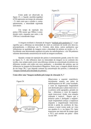Como pode ser observado na
figura 23, o líquido encéfalo-raqüídeo
(CFS) apresenta um tempo de relaxação
- T1 mais curto que o cérebro e, conse-
qüentemente, a intensidade registrada
será menor.
Um tempo de repetição dos
pulsos (TR) menor que 500ms é consi-
derado curto, enquanto que outro, o de
1500 ms é considerado longo.
Figura 23.
A imagem resultante é chamada de imagem “mediada pelo parâmetro T1”, o que
significa que a diferença na intensidade do sinal ou contraste do tecido alvo deve-se,
principalmente, a diferenças em T1. Existem, além deste, outros parâmetros que
influenciam na qualidade da imagem como a densidade de prótons no tecido e o T2.
Escolhendo uma determinada sequência de pulso da radiofrequência e do TR podemos
salientar determinada característica do tecido na imagem resultante.
Quando o tempo de repetição dos pulsos é extremamente grande, como foi visto
na figura 21, T1 não influencia mais na intensidade da imagem ou no contraste dos
tecidos, mas sempre pode existir uma diferença mínima na concentração de prótons nos
diferentes tecidos, será então este novo parâmetro - a densidade dos prótons, que irá
influenciar na imagem de Ressonância Magnética. Neste caso, a imagem obtida através
de um longo TR, e que depende somente da concentração dos prótons, é chamada de
“imagem mediada pela densidade de prótons”.
Como obter uma “imagem mediada pelo tempo de relaxação T2 ?
Figura 24.
Observemos a seguinte experiência:
inicialmente usamos um pulso de
radiofrequência de 90º; como resultado,
o vetor da magnetização longitudinal
será deslocado para o plano transverso e
os prótons serão agrupados, girando em
fase - obteremos o vetor da magneti-
zação transversal. Ainda, essa situação
ordenada é instável. Depois que o
primeiro pulso é desligado a magneti-
zação longitudinal começa a reaparecer
enquanto a magnetização transversal,
devido à perda da coerência de fase,
começa a sumir (como pode ser visto
nos quadros b e c na figura 25). Após
transcorrer um intervalo de tempo igual
a TE/2, será emitido um pulso - desta
vez de 180º.
 