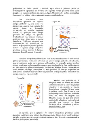 procedemos de forma similar à anterior. Após emitir o primeiro pulso de
radiofrequência, aplicamos no paciente um segundo campo gradiente numa outra
direção, por exemplo, ao longo do eixo y. A figura 33 mostra isto: na fatia tomográfica
(imagem A) os prótons estão precessando com a mesma frequência.
Para discriminar estas
frequências aplicamos um segundo
campo gradiente Gy que desta vez
decresce da esquerda para a direita. Da
mesma forma, as frequências
decrescerão no sentido esquerda-
direita. A aplicação deste campo
gradiente Gy obriga os prótons,
localizados em cada uma das colunas, a
emitirem seus sinais com a mesma
frequência. Verifica-se, portanto, uma
discriminação das frequências em
função da posição dos prótons; por este
motivo o segundo campo magnético
gradiente aplicado também é chamado
de campo decodificador de frequência .
Figura 33.
Mas ainda não podemos identificar o local exato em cada coluna de onde o sinal
partiu; teoricamente poderíamos introduzir um terceiro campo gradiente. Não obstante,
este procedimento pode trazer algumas dificuldades, por exemplo, podem resultar
pontos localizados em lugares diferentes com a mesma frequência. Este problema pode
ser solucionado se aplicarmos um campo gradiente Gx ao longo de uma coluna por um
curto intervalo de tempo (vide figura 34). Este gradiente faz com que os prótons em
cada coluna aumentem sua velocidade de precessão, correspondendo à intensidade do
campo magnético experimentado.
Figura 34.
Quando este gradiente Gx é
desligado, todos os prótons na coluna
sentirão novamente o campo magnético
originário e apresentarão a mesma
frequência de precessão. Só que agora
os prótons estarão fora de fase e esta
defasagem pode ser registrada na antena
como um atraso na chegada dos
diferentes sinais. Já que este último
gradiente Gx aplicado no paciente leva à
precessão dos prótons em fases
diferentes, ele é chamado de gradiente
decodificador de fase.
Em resumo, após a aplicação dos campos magnéticos gradientes, acima
descritos, registramos uma mistura de diferentes sinais. Alguns desses têm frequências
variadas e outros, com a mesma frequência, possuem fases diferentes; considerando a
localização do próton perturbado.
 
