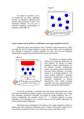 No estado de equilíbrio, isto é,
na ausência de um campo magnético
externo, os momentos magnéticos dos
prótons estão orientados ao acaso. Esta
orientação aleatória faz com que o
momento magnético macroscópico no
paciente se anule (M = 0).
Figura 5.
O que acontece com os prótons se submetidos a um campo magnético externo?
Os prótons agem como pequenos ímãs - alinham-se espontaneamente ao longo
das linhas de força do campo magnético externo, da mesma forma como as agulhas de
uma bússola se orientam no campo magnético da terra; mas com uma diferença
fundamental: as agulhas da bússola orientam-se numa única direção.
Figura 6.
Os prótons, no entanto, podem
orientar seus momentos magnéticos em
duas direções: em direção ao campo
magnético externo (paralelamente) ou
em direção contrária (antiparalela-
mente); em cada uma dessas orientações
possuem valores diferentes de energia
potencial. A orientação paralela é a de
menor energia potencial e, portanto,
representa a situação mais estável. Na
orientação antiparalela os prótons
encontram-se num estado excitado
possuindo uma maior energia potencial,
superior à energia do estado paralelo.
Os prótons escolherão a orientação que exija menor energia potencial; assim
uma maior quantidade de prótons ocupará o nível mais baixo de energia, isto é, terão
seus momentos magnéticos orientados em direção ao campo magnético. Para 10 7
prótons antiparalelos, por exemplo, haverá 10 7
+ 7 prótons paralelos ao campo
magnético e são justamente estes 7 prótons móveis que têm grande importância na
técnica de Ressonância Magnética.
Observemos mais atentamente estes prótons: num campo magnético externo os
prótons não estão totalmente enfileirados junto às linhas de força deste campo; eles se
movimentam de maneira similar ao movimento que realiza o pião sobre a terra.
 
