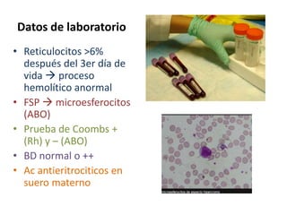Datos de laboratorio
• Reticulocitos >6%
  después del 3er día de
  vida  proceso
  hemolítico anormal
• FSP  microesferocitos
  (ABO)
• Prueba de Coombs +
  (Rh) y – (ABO)
• BD normal o ++
• Ac antieritrociticos en
  suero materno
 