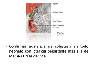 • Confirmar existencia de colestasis en todo
  neonato con ictericia persistente más allá de
  los 14-21 días de vida.
 