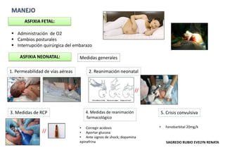 ASFIXIA NEONATAL:
1. Permeabilidad de vías aéreas 2. Reanimación neonatal
3. Medidas de RCP
 Administración de O2
 Cambios posturales
 Interrupción quirúrgica del embarazo
ASFIXIA FETAL:
//
//
4. Medidas de reanimación
farmacológico
• Corregir acidosis
• Aportar glucosa
• Ante signos de shock; dopamina
epinefrina
5. Crisis convulsiva
• Fenobarbital 20mg/k
Medidas generales
SAGREDO RUBIO EVELYN RENATA
 
