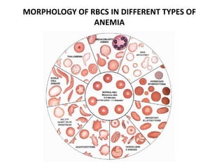 Iron and anemia | PPTX