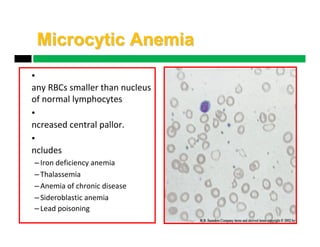 Iron and vitamin d deficiency | PDF
