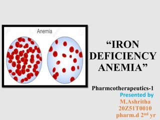 “IRON
DEFICIENCY
ANEMIA”
Pharmcotherapeutics-1
Presented by
M.Ashritha
20Z51T0010
pharm.d 2nd yr
.
 