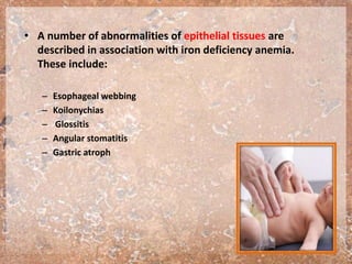 • A number of abnormalities of epithelial tissues are
described in association with iron deficiency anemia.
These include:
– Esophageal webbing
– Koilonychias
– Glossitis
– Angular stomatitis
– Gastric atroph
 