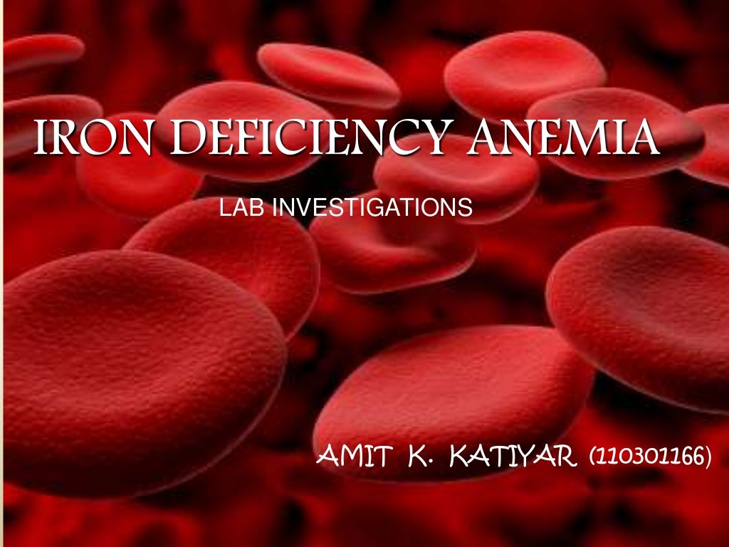 Iron deficiency anemia Investigations