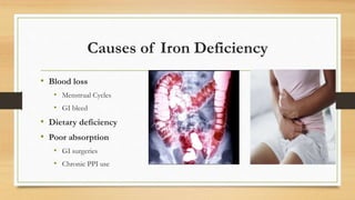 iron deficiency anemia slide