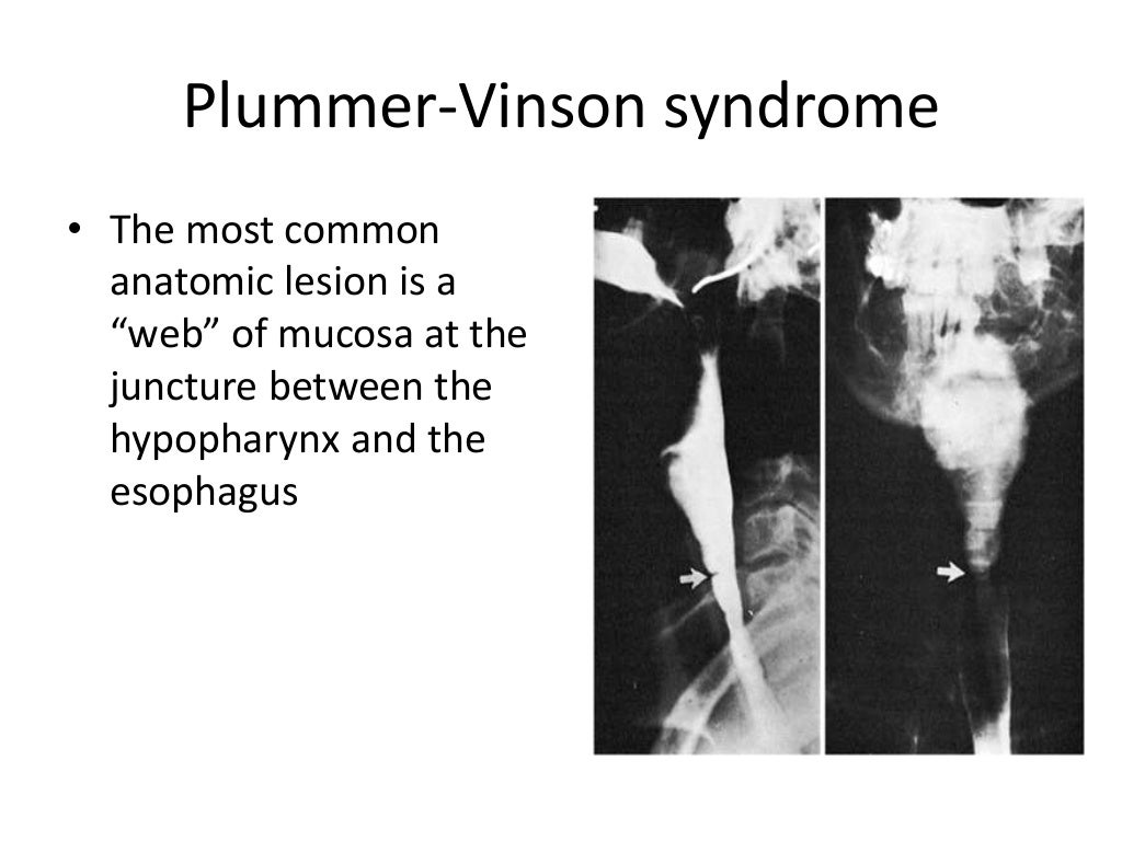 Iron deficiency anemia pathogenesis and lab diagnosis