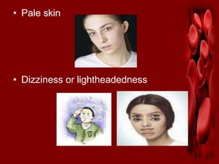 • Pale skin
• Dizziness or lightheadedness
 