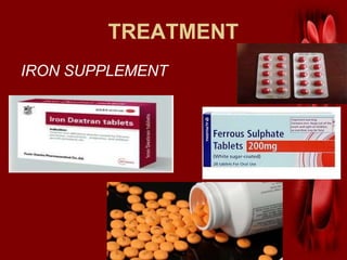 TREATMENT
IRON SUPPLEMENT
 