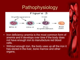 Pathophysiology
• Iron deficiency anemia is the most common form of
anemia and it develops over time if the body does
not have enough iron to manufacture red blood
cells.
• Without enough iron, the body uses up all the iron it
has stored in the liver, bone marrow and other
organs.
 