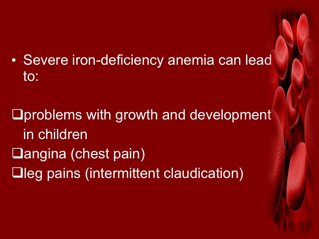 Iron deficiency anemia.