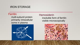 Iron deficiency anemia final | PPTX