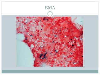 Bma Inj Image IRON METABOLISM AND IRON DEFICIENCY ANAEMIA BABACOCK.pptx