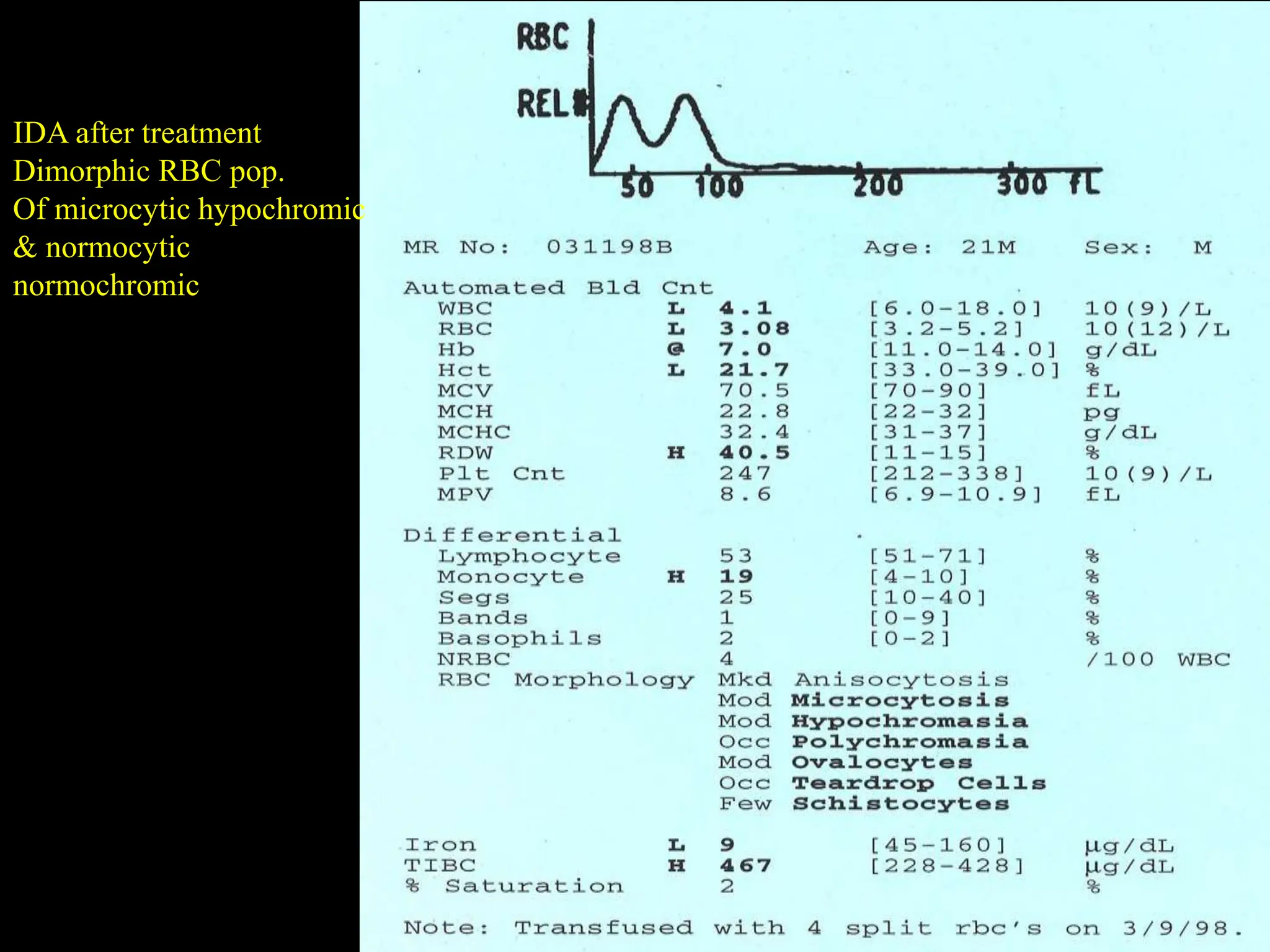 IRON METABOLISM & MICROCYTIC HYPOCHROMIC ANAEMIAS.pptx