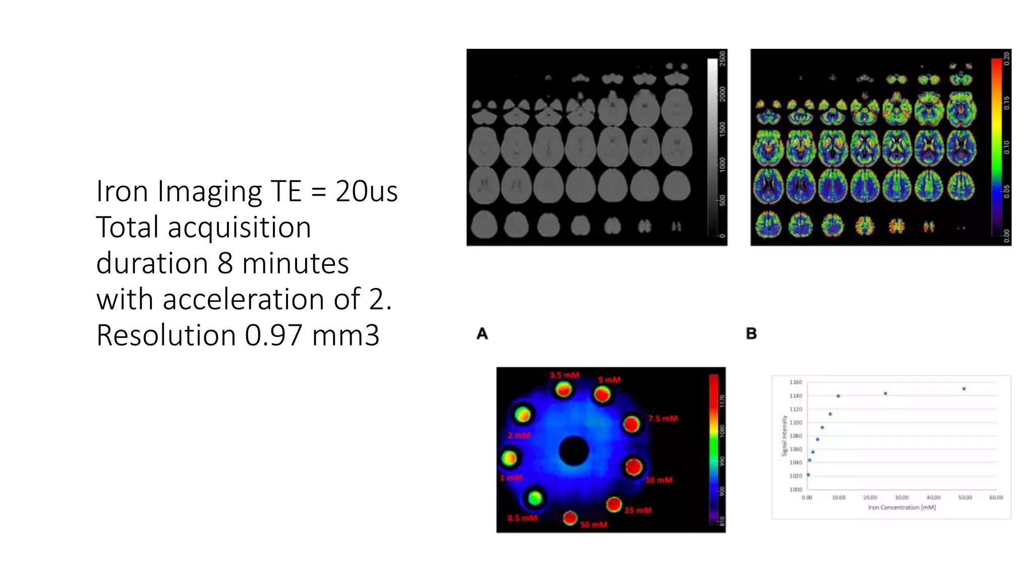 High Resolution 3D UltraShort Echo Time MRI with Rosette kSpace Pat…