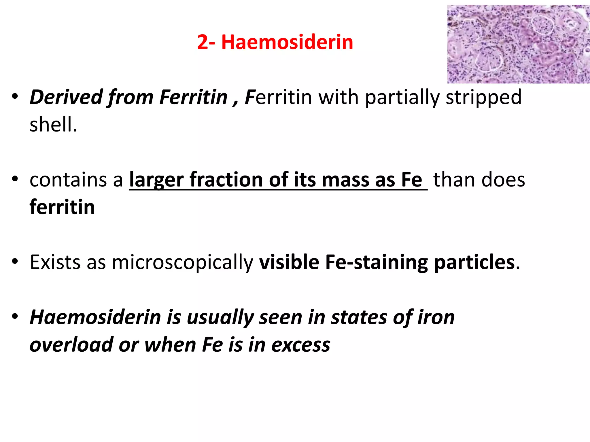 2- Haemosiderin
• Derived from Ferritin , Ferritin with partially stripped
shell.
• contains a larger fraction of its mass as Fe than does
ferritin
• Exists as microscopically visible Fe-staining particles.
• Haemosiderin is usually seen in states of iron
overload or when Fe is in excess
 