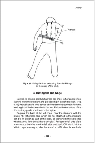 Hitting




                                                          Kidneys




         Fig. 4.19 Hitting the lines ext...
