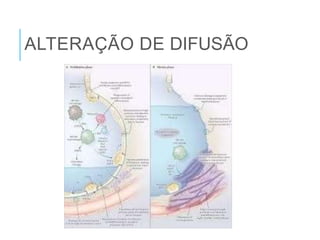 ALTERAÇÃO DE DIFUSÃO
 