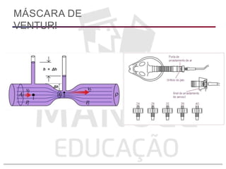 MÁSCARA DE
VENTURI
 