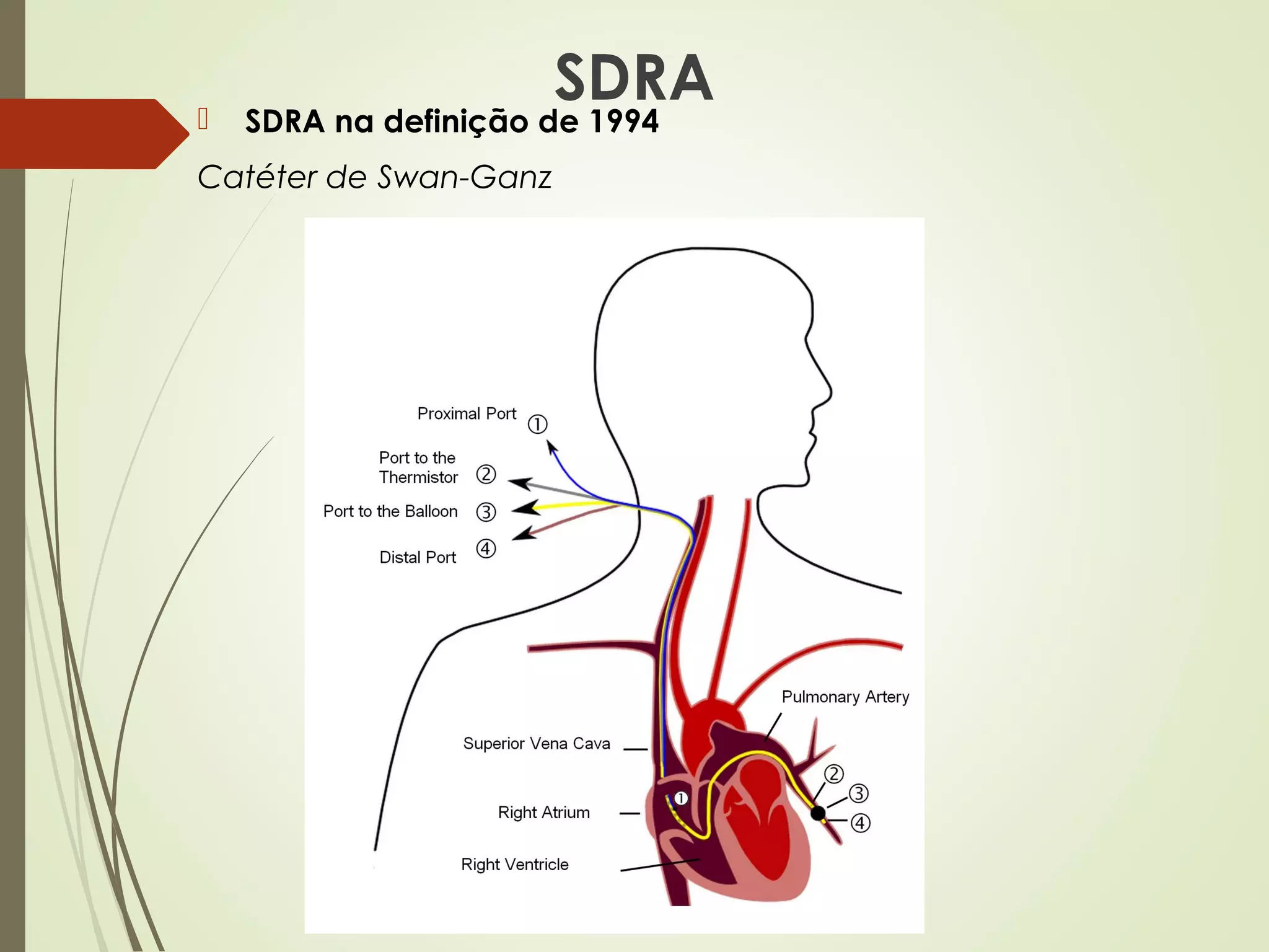 Insuficiência Respiratória Aguda (IRpA) e Síndrome do Desconforto ...