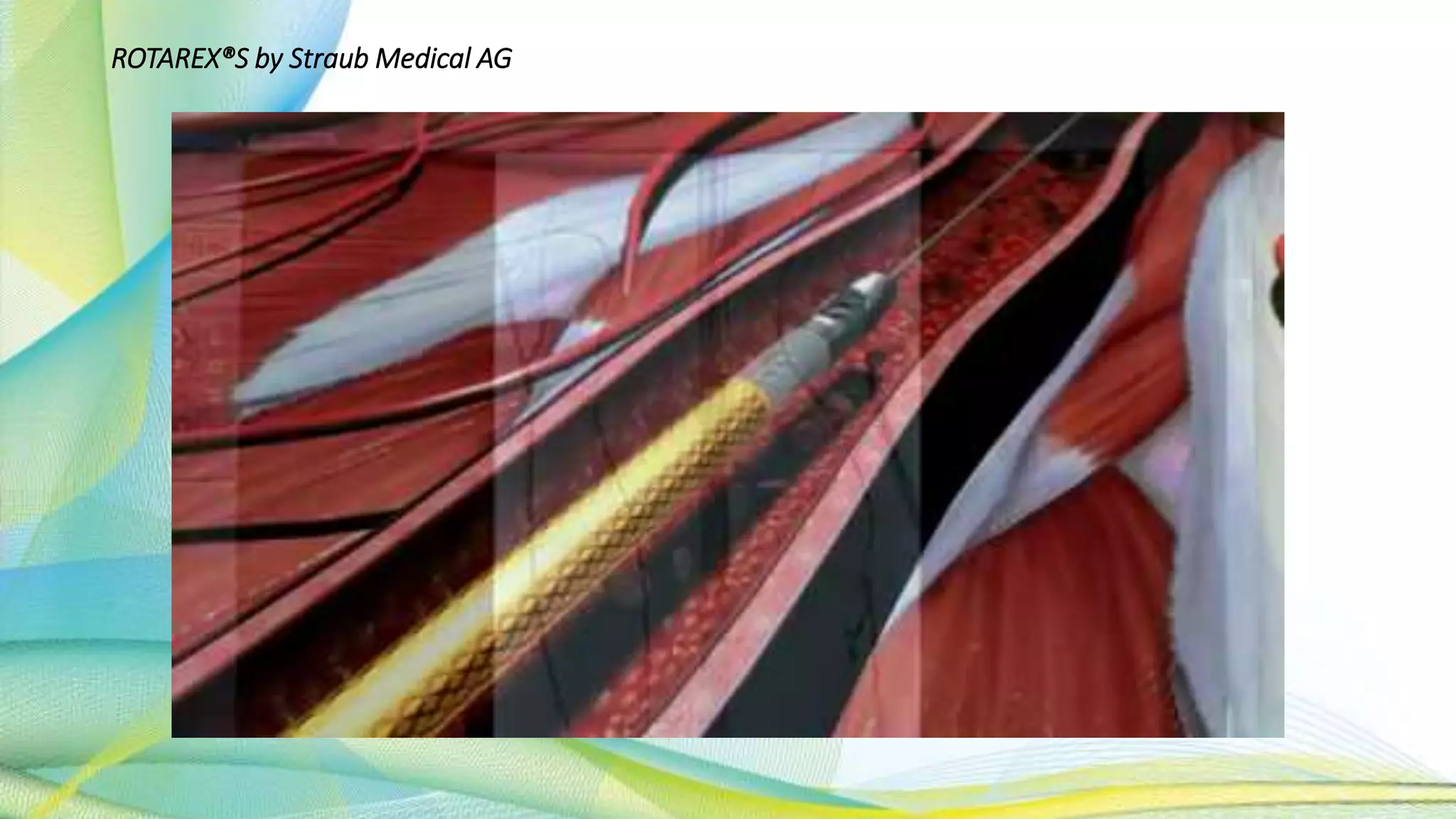 ROTAREX®S by Straub Medical AG
 