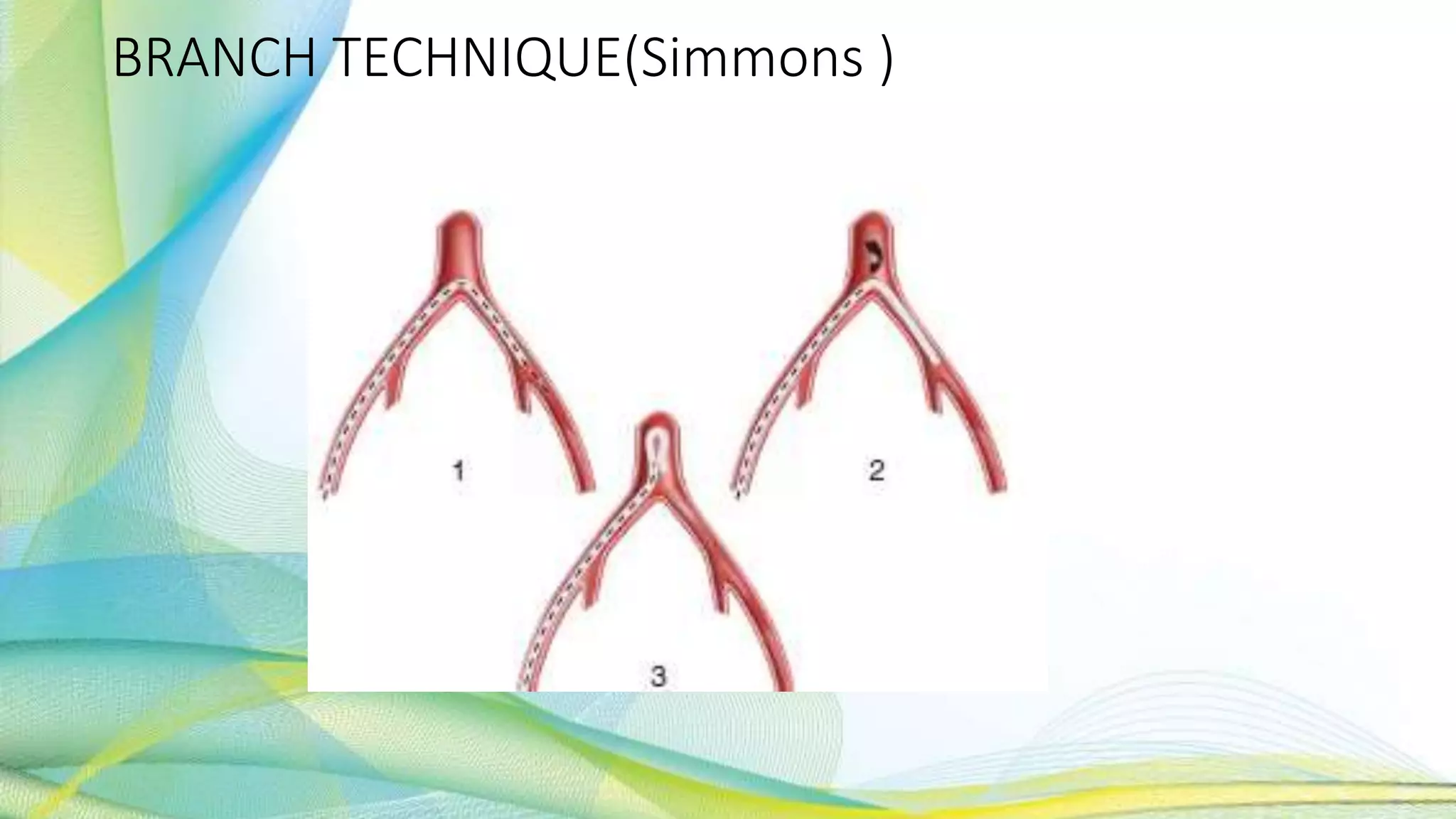 BRANCH TECHNIQUE(Simmons )
 