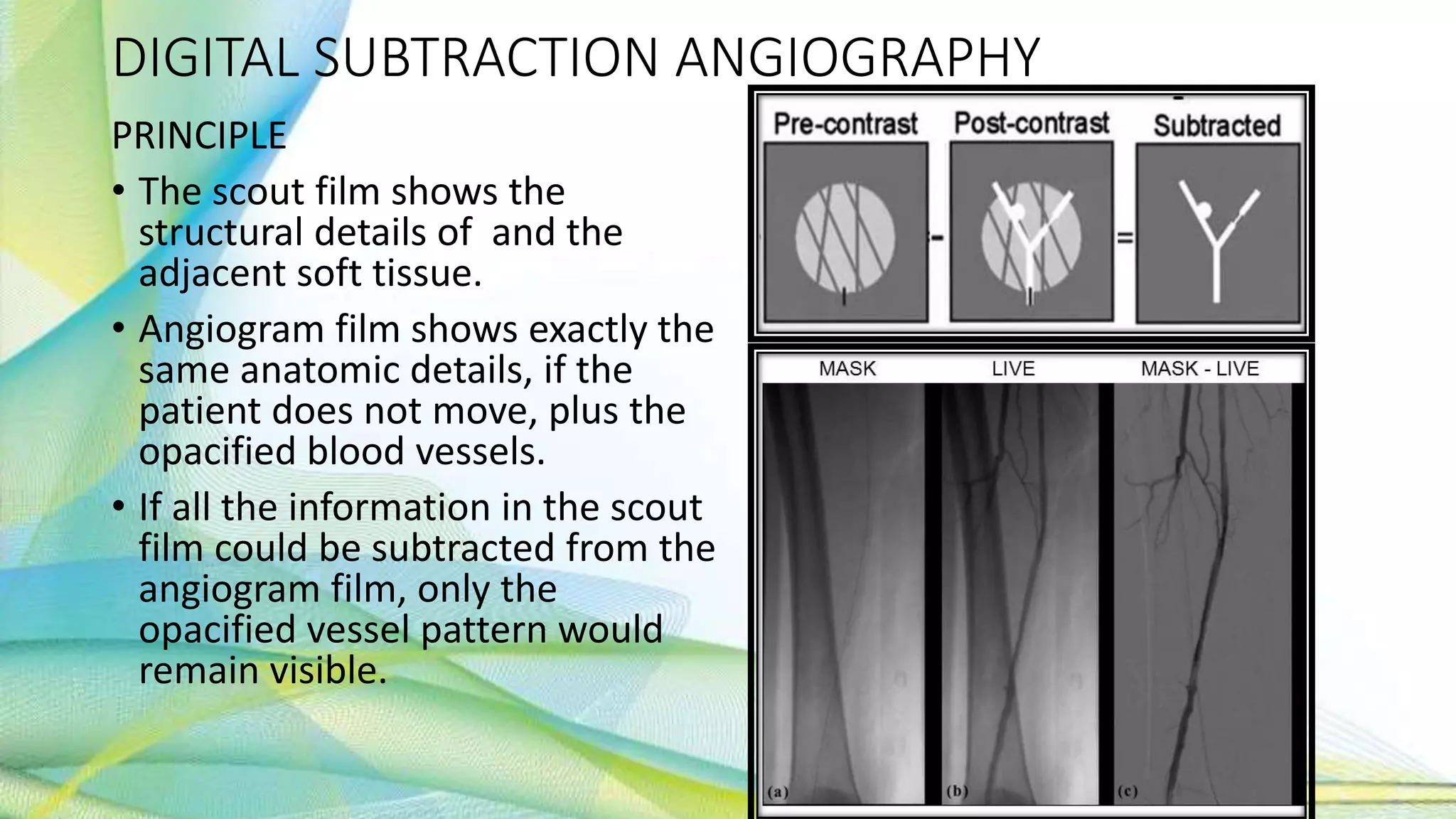DIGITAL SUBTRACTION ANGIOGRAPHY
PRINCIPLE
• The scout film shows the
structural details of and the
adjacent soft tissue.
• Angiogram film shows exactly the
same anatomic details, if the
patient does not move, plus the
opacified blood vessels.
• If all the information in the scout
film could be subtracted from the
angiogram film, only the
opacified vessel pattern would
remain visible.
 