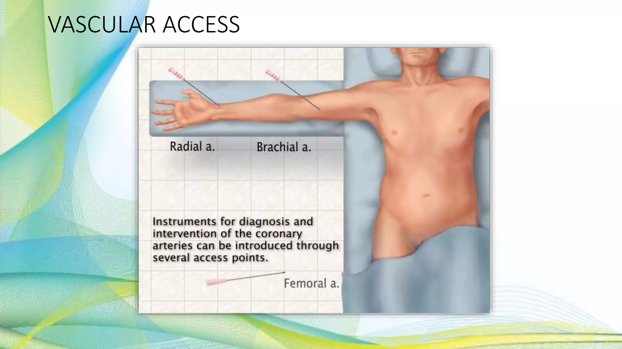 VASCULAR ACCESS
 