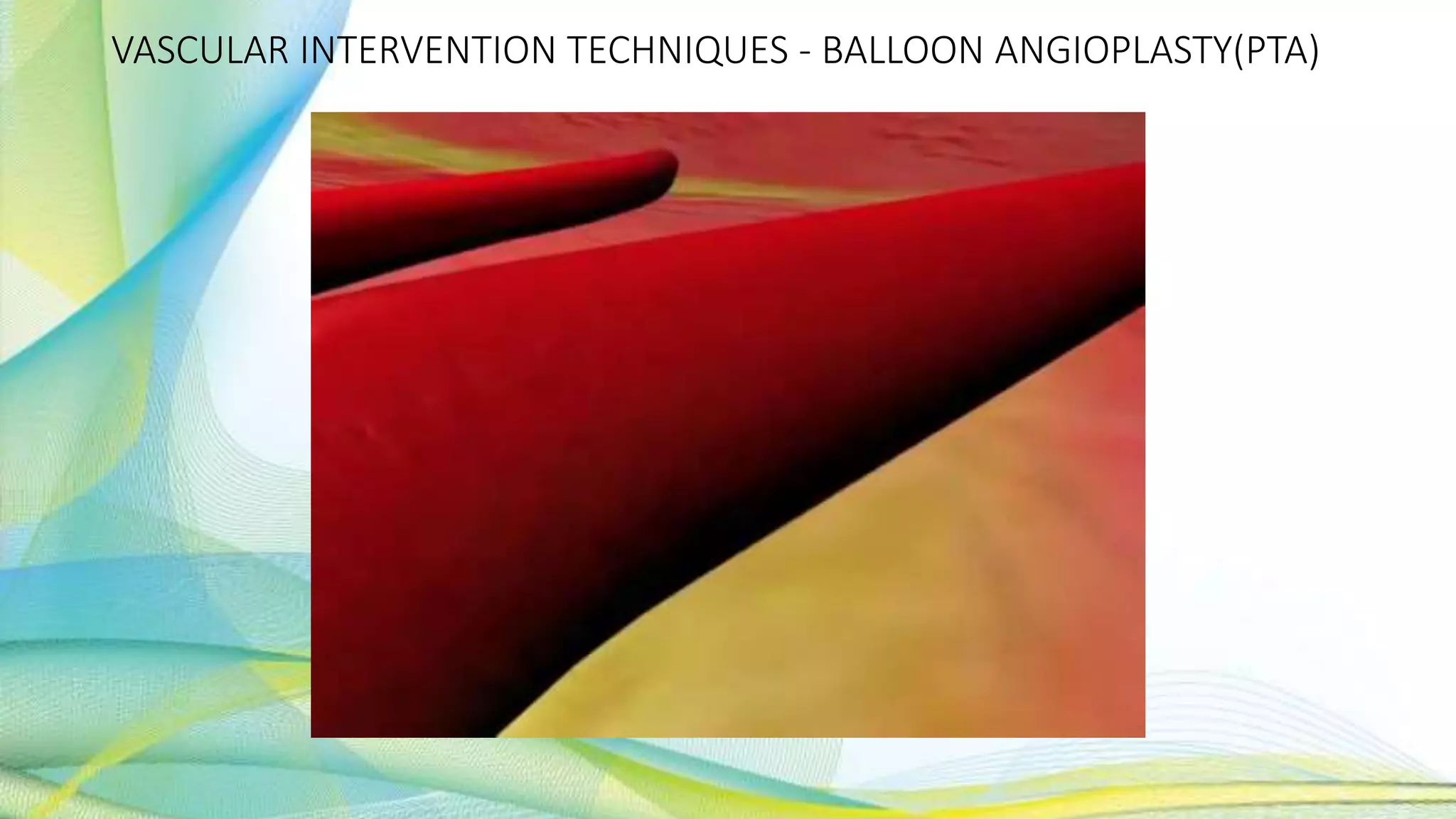 VASCULAR INTERVENTION TECHNIQUES - BALLOON ANGIOPLASTY(PTA)
 