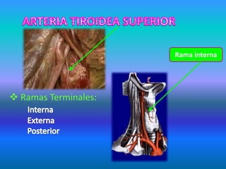  Ramas Terminales:
Rama interna
 
