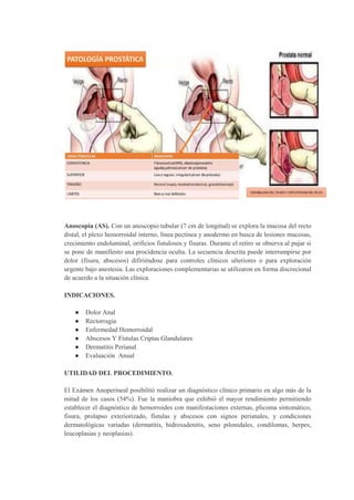 Anoscopía (AS). Con un anoscopio tubular (7 cm de longitud) se explora la mucosa del recto
distal, el plexo hemorroidal interno, línea pectínea y anodermo en busca de lesiones mucosas,
crecimiento endoluminal, orificios fistulosos y fisuras. Durante el retiro se observa al pujar si
se pone de manifiesto una procidencia oculta. La secuencia descrita puede interrumpirse por
dolor (fisura, abscesos) difiriéndose para controles clínicos ulteriores o para exploración
urgente bajo anestesia. Las exploraciones complementarias se utilizaron en forma discrecional
de acuerdo a la situación clínica.
INDICACIONES.
● Dolor Anal
● Rectorragia
● Enfermedad Hemorroidal
● Abscesos Y Fístulas Criptas Glandulares
● Dermatitis Perianal
● Evaluación Anual
UTILIDAD DEL PROCEDIMIENTO.
El Exámen Anoperineal posibilitó realizar un diagnóstico clínico primario en algo más de la
mitad de los casos (54%). Fue la maniobra que exhibió el mayor rendimiento permitiendo
establecer el diagnóstico de hemorroides con manifestaciones externas, plicoma sintomático,
fisura, prolapso exteriorizado, fístulas y abscesos con signos perianales, y condiciones
dermatológicas variadas (dermatitis, hidroxadenitis, seno pilonidales, condilomas, herpes,
leucoplasias y neoplasias).
 