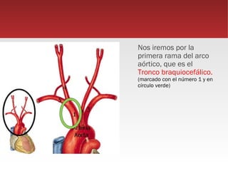 Nos iremos por la
primera rama del arco
aórtico, que es el
Tronco braquiocefálico.
(marcado con el número 1 y en
círculo verde)
 