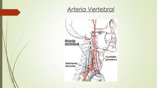 Arteria Vertebral 
 