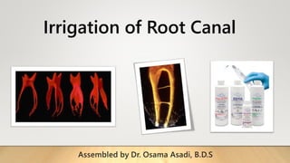 Irrigation of Root Canal
Assembled by Dr. Osama Asadi, B.D.S
 