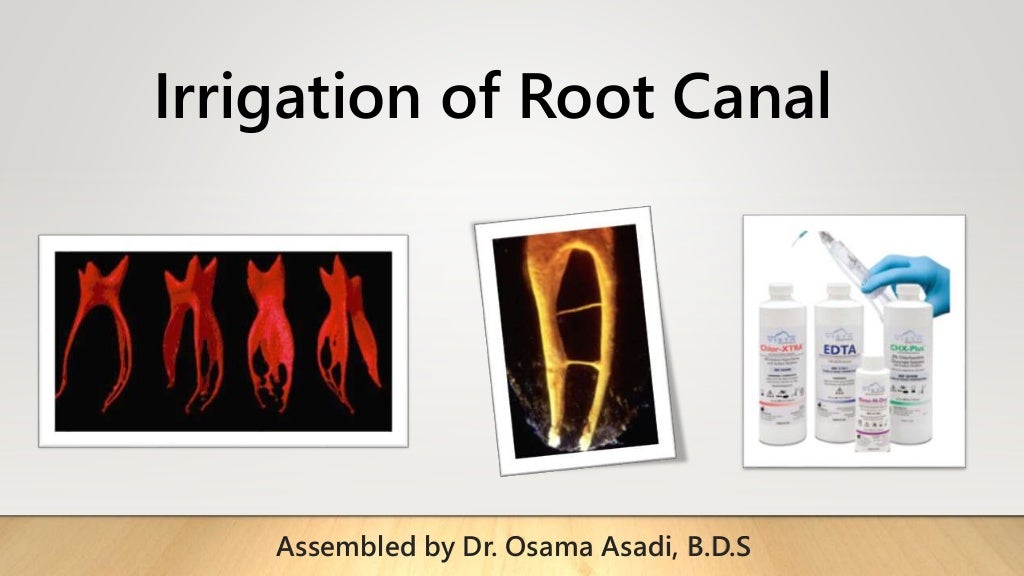 Root Canal Irrigation During Endodontic Treatment