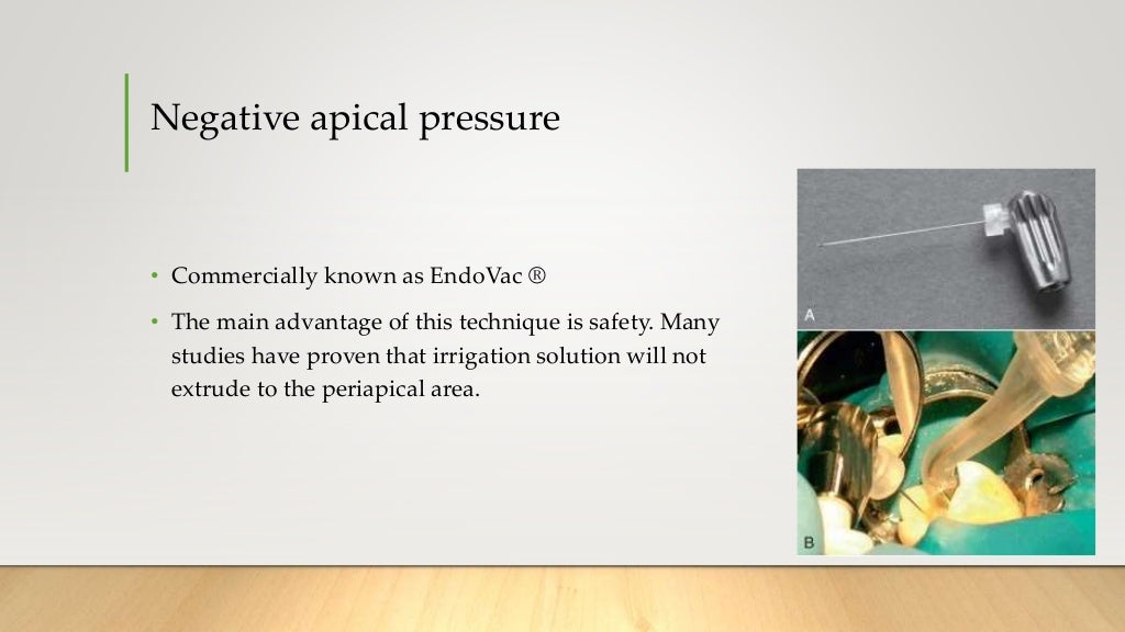 Root Canal Irrigation During Endodontic Treatment