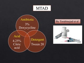 MTAD
Antibiotic
3%
Doxycycline
Detergent
Tween 20
Acid
4.25%
Citric
acid
By Torabinejad et al
 
