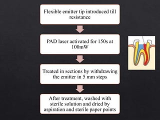 Flexible emitter tip introduced till
resistance
PAD laser activated for 150s at
100mW
Treated in sections by withdrawing
the emitter in 5 mm steps
After treatment, washed with
sterile solution and dried by
aspiration and sterile paper points
 