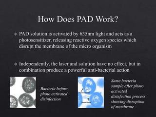 Bacteria before
photo activated
disinfection
Same bacteria
sample after photo
activated
disinfection process
showing disruption
of membrane
 
