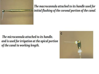 Irrigants and Irrigation Devices