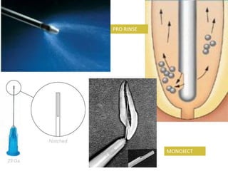PRO RINSE

MONOJECT

 