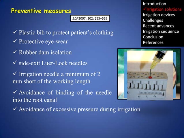 Irrigation in endodontics | PPTX