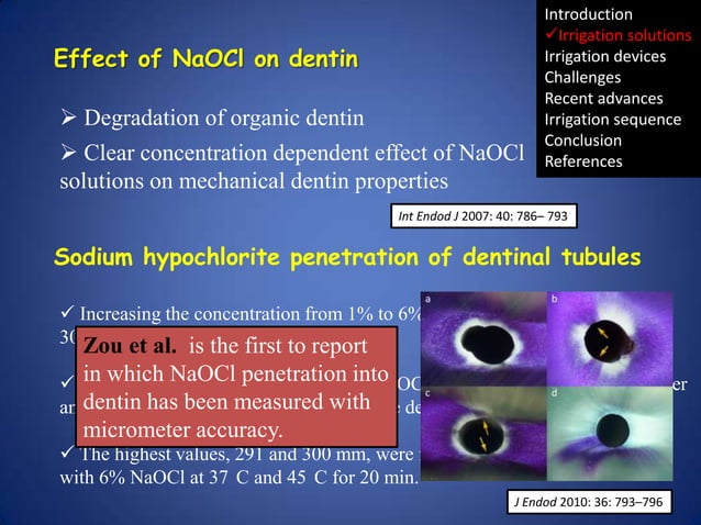 Irrigation in endodontics | PPTX