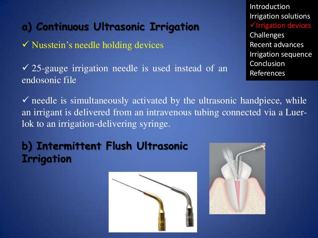 Irrigation in endodontics