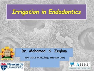 Irrigation in Endodontics
Irrigation in Endodontics
Dr. Mohamed S. Zeglam
BDS, MFDS RCPS(Glasg), MSc (Rest Dent)
BDS, MFDS RCPS(Glasg), MSc (Rest Dent)
 