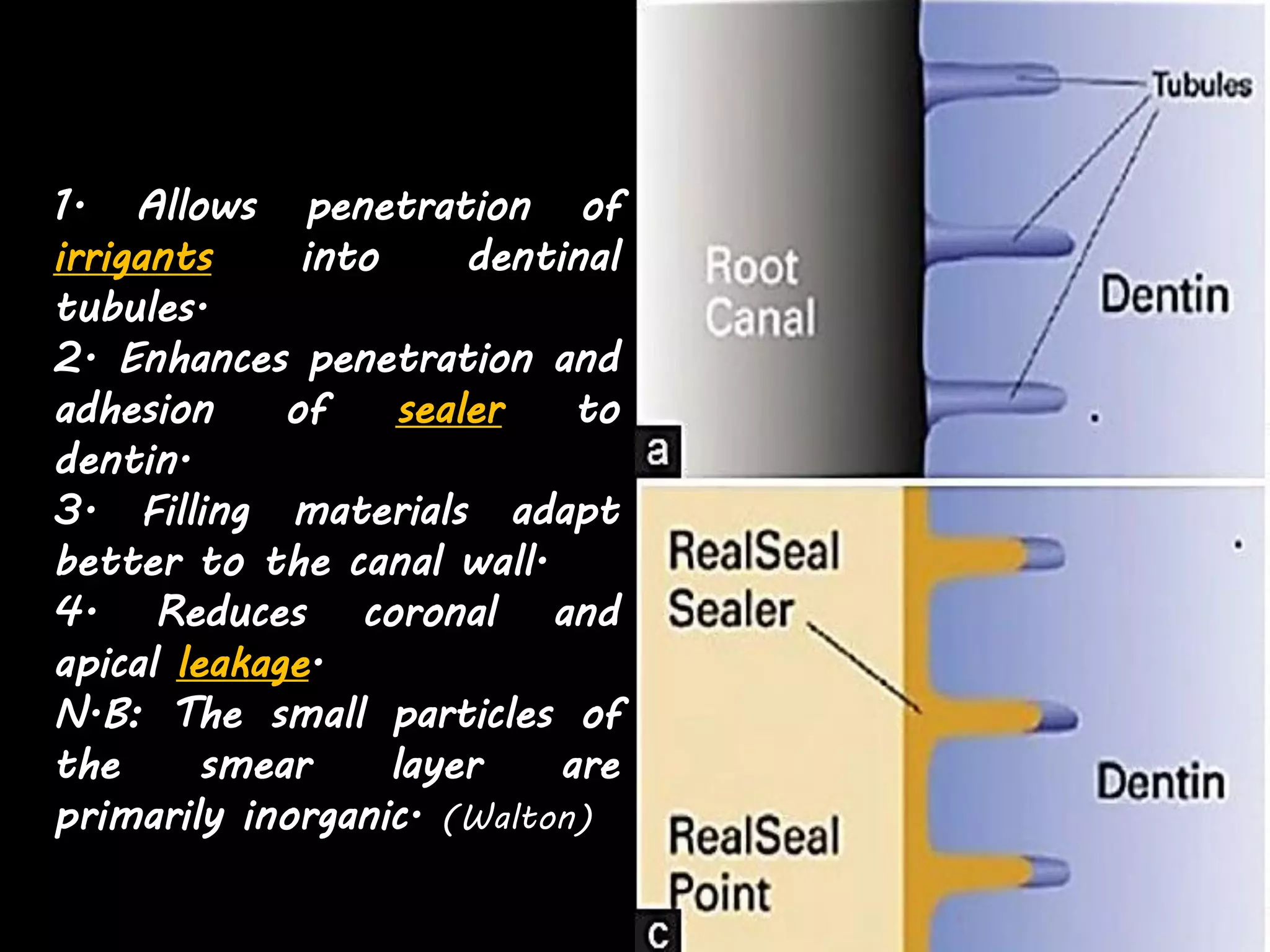 Irrigation in Endodontics.pdf